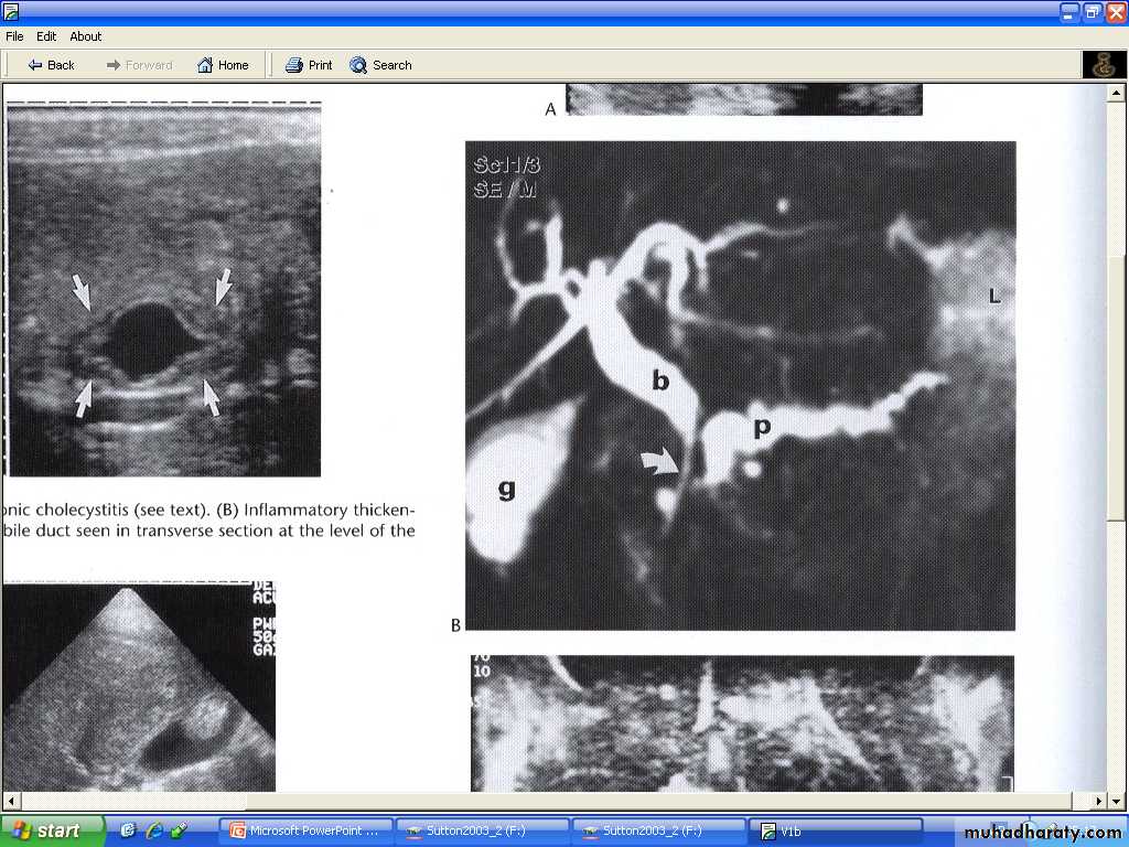 Liver& Biliary