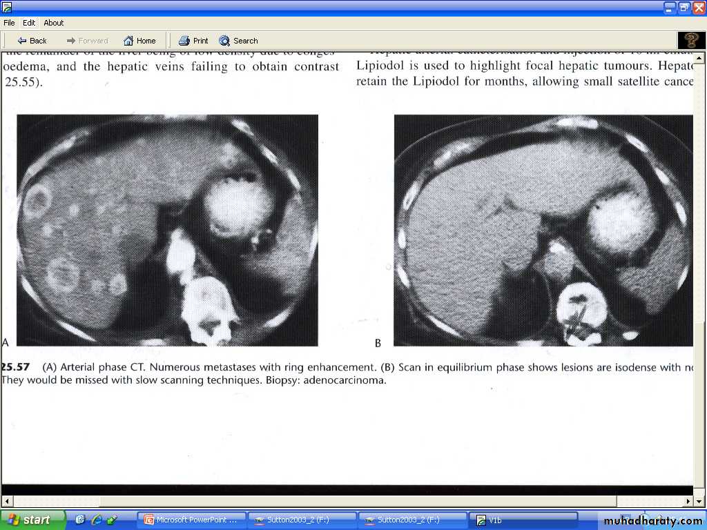 Liver& Biliary