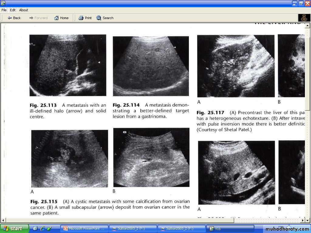 Liver& Biliary