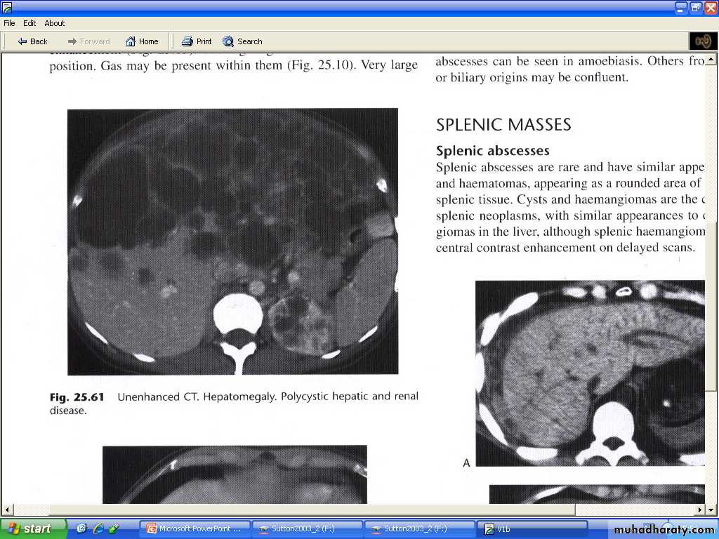 Liver& Biliary