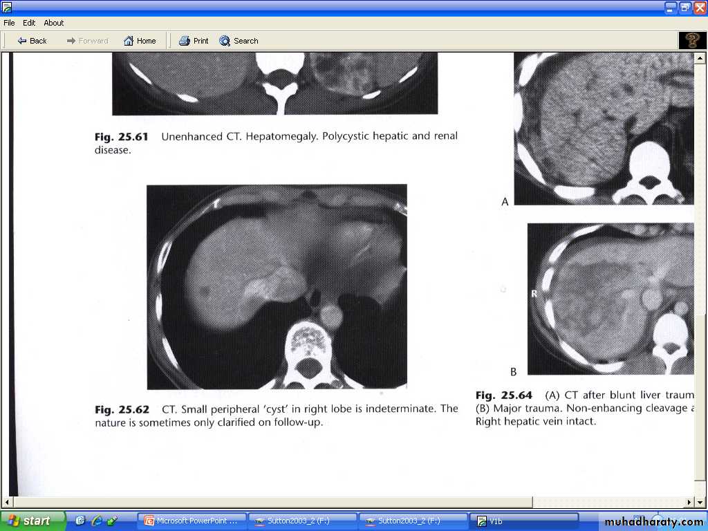 Liver& Biliary