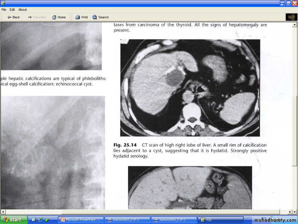 Liver& Biliary