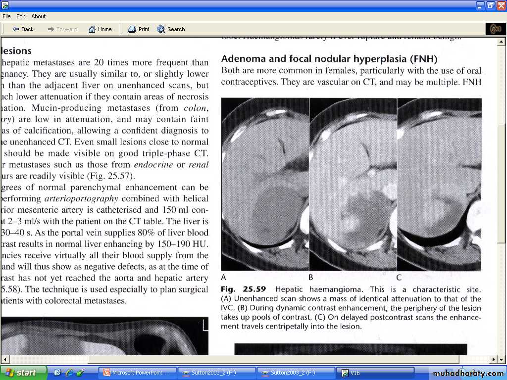 Liver& Biliary