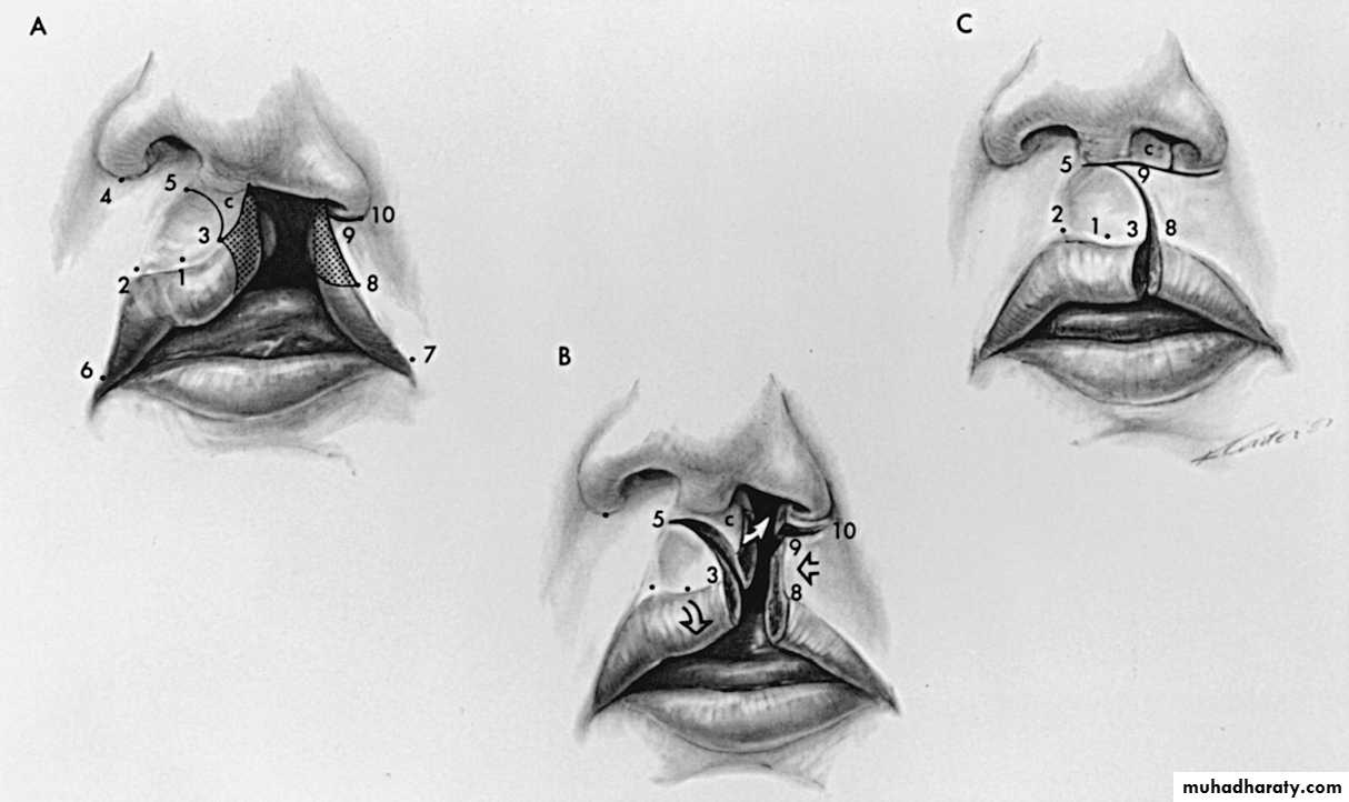 Cleft Palate & Cosmetic Operations