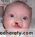 Cleft Palate & Cosmetic Operations