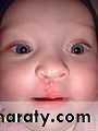 Cleft Palate & Cosmetic Operations