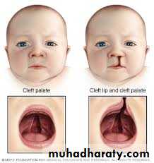 Cleft Palate & Cosmetic Operations