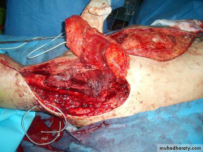 Cleft Palate & Cosmetic Operations