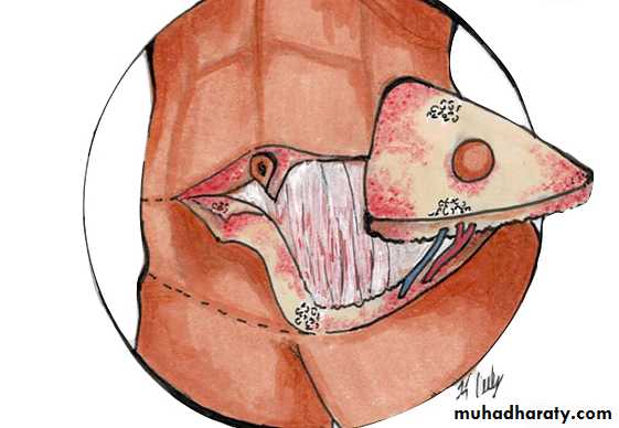 Cleft Palate & Cosmetic Operations