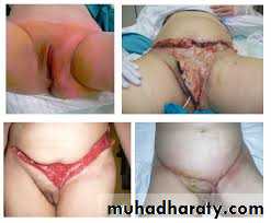 Cleft Palate & Cosmetic Operations