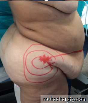 Cleft Palate & Cosmetic Operations