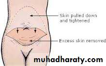 Cleft Palate & Cosmetic Operations