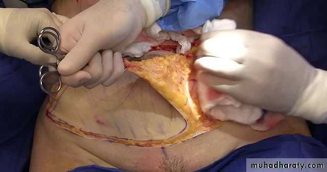Cleft Palate & Cosmetic Operations