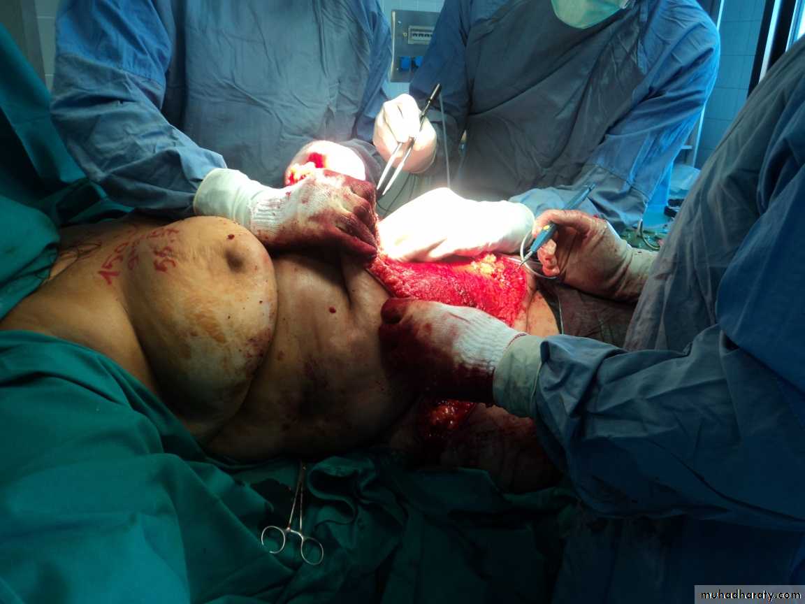 Cleft Palate & Cosmetic Operations