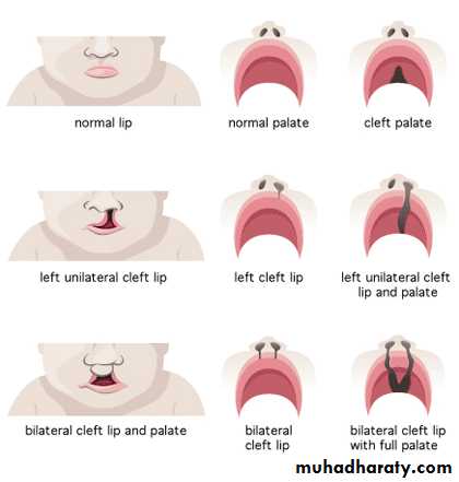 Cleft Palate & Cosmetic Operations