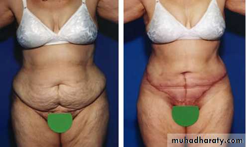 Cleft Palate & Cosmetic Operations