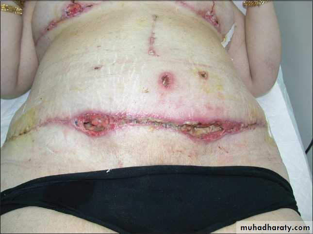 Cleft Palate & Cosmetic Operations