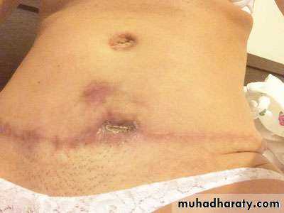 Cleft Palate & Cosmetic Operations