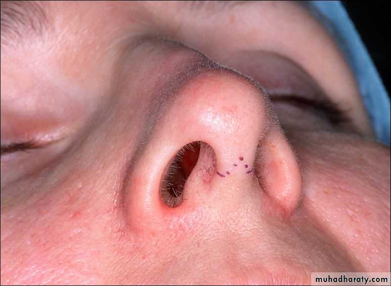 Cleft Palate & Cosmetic Operations