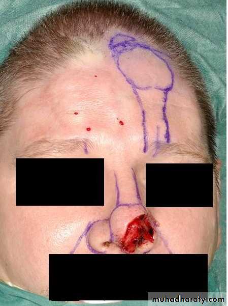 Cleft Palate & Cosmetic Operations