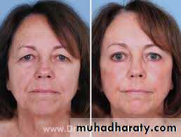 Cleft Palate & Cosmetic Operations