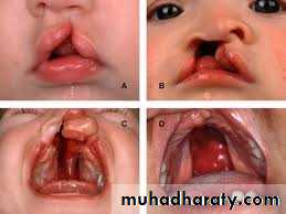 Cleft Palate & Cosmetic Operations