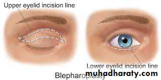 Cleft Palate & Cosmetic Operations