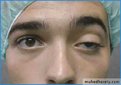 Cleft Palate & Cosmetic Operations