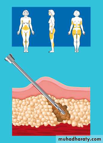 Cleft Palate & Cosmetic Operations