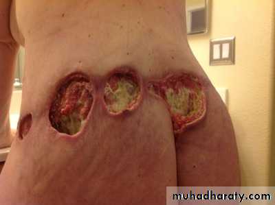 Cleft Palate & Cosmetic Operations