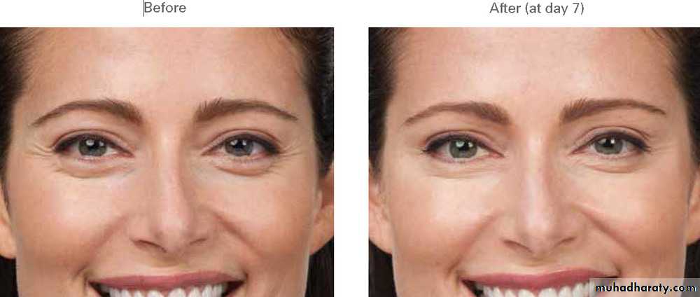Cleft Palate & Cosmetic Operations