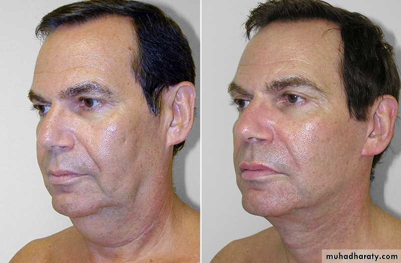 Cleft Palate & Cosmetic Operations