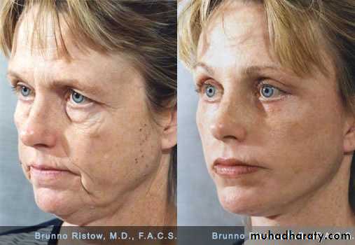Cleft Palate & Cosmetic Operations