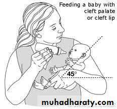 Cleft Palate & Cosmetic Operations