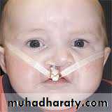 Cleft Palate & Cosmetic Operations