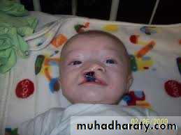 Cleft Palate & Cosmetic Operations