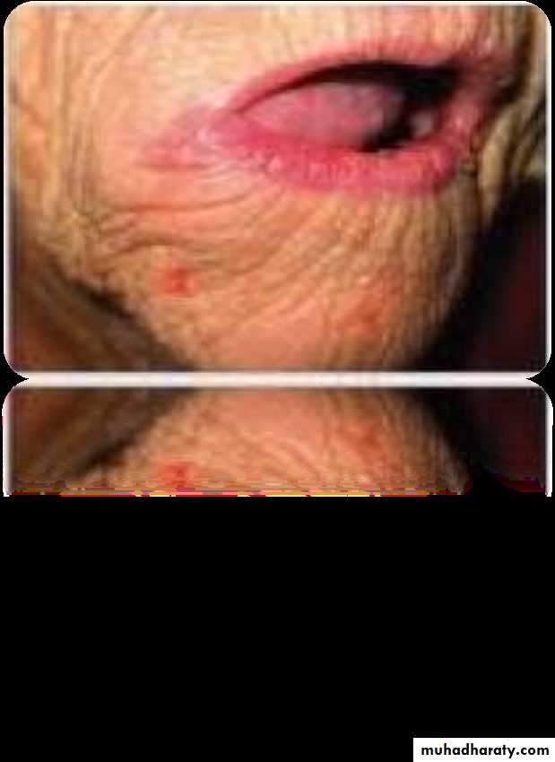 Giatric