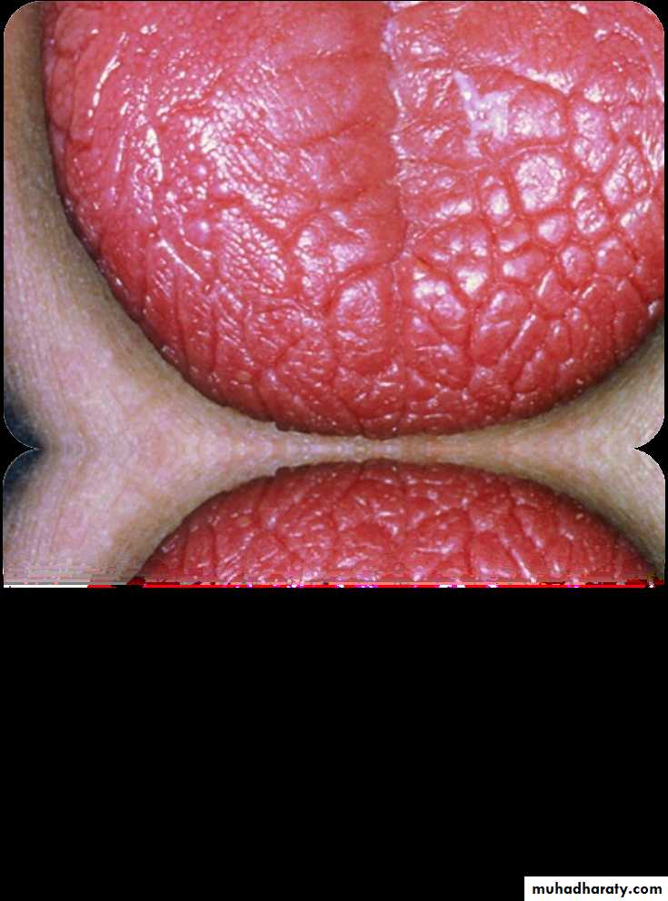 Giatric