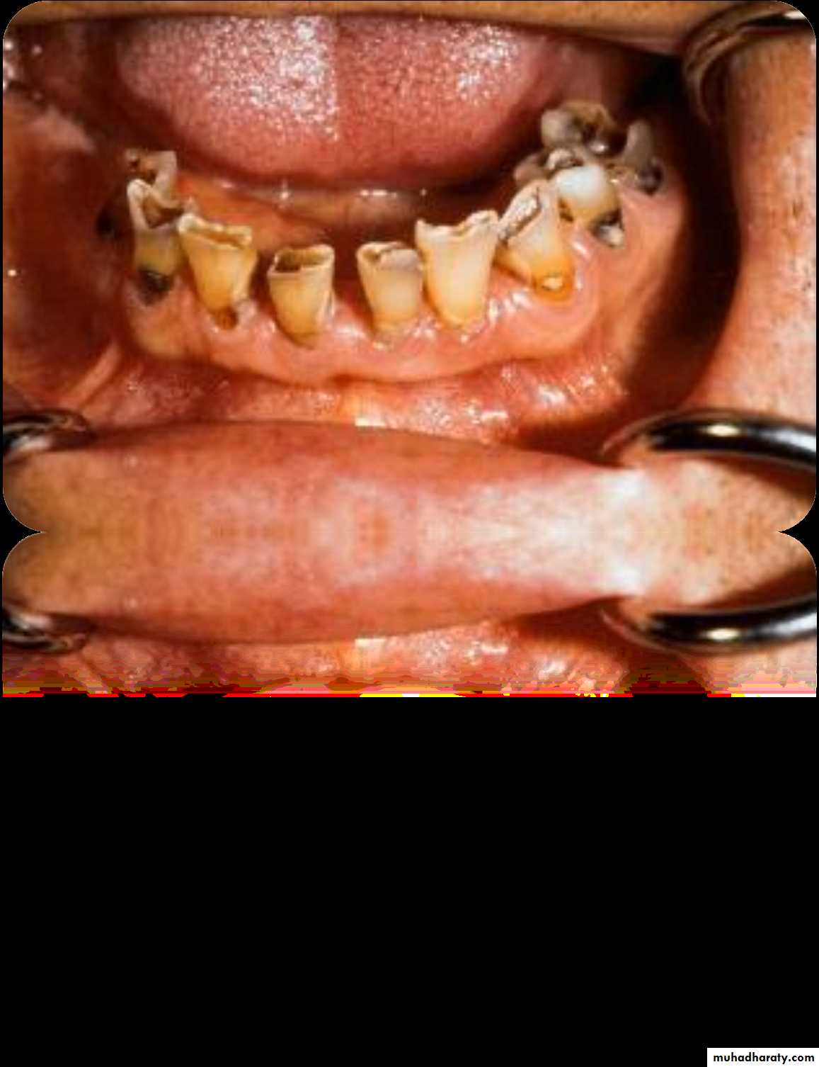 Giatric