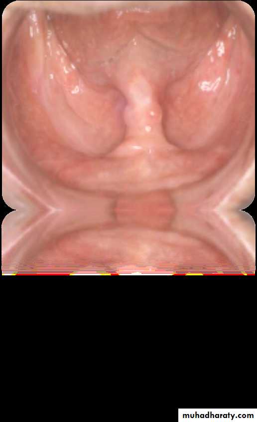 Giatric