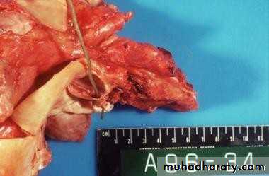 medically compromised patient