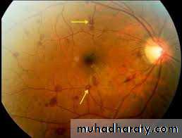 medically compromised patient