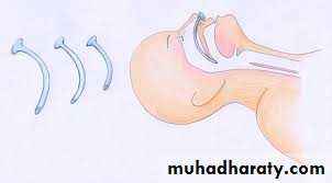 Airway Control