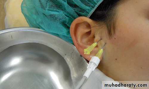 orofacial pain