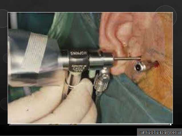 orofacial pain