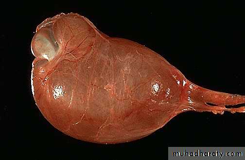 Genital Tract