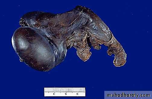 Genital Tract