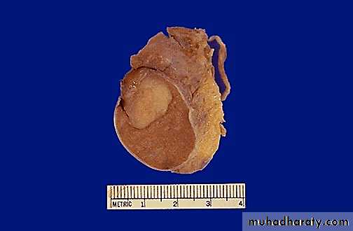 Genital Tract