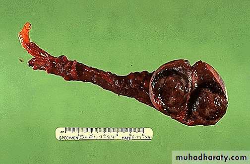 Genital Tract