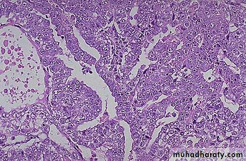 Genital Tract